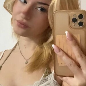 funny_freckle video